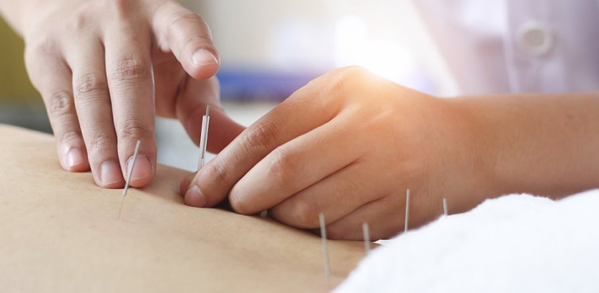 Dry Needling Spine Clinic Ortho Neuro Physiotherapy Clinic